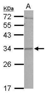 CCDC127 Antibody in Western Blot (WB)