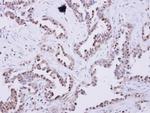 GFM2 Antibody in Immunohistochemistry (IHC)
