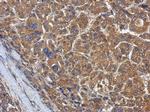 KLHL22 Polyclonal Antibody