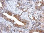 GCNT3 Polyclonal Antibody