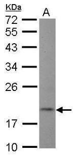NT5C Polyclonal Antibody