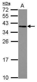 LOX-1 Antibody in Western Blot (WB)