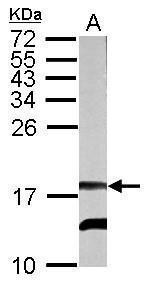 RFESD Antibody in Western Blot (WB)