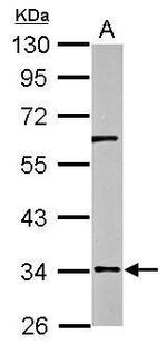 RPUSD3 Polyclonal Antibody