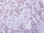 CBR4 Polyclonal Antibody