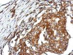 QTRTD1 Polyclonal Antibody