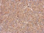 CCDC105 Polyclonal Antibody