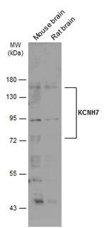 KCNH7 Antibody in Western Blot (WB)