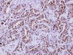 PHD1 Antibody in Immunohistochemistry (Paraffin) (IHC (P))
