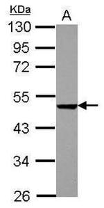 PHD1 Antibody in Western Blot (WB)