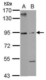 ARMC3 Polyclonal Antibody