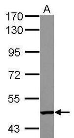 TC2N Polyclonal Antibody