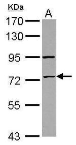 ZNF530 Antibody in Western Blot (WB)