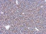 MRPL14 Antibody in Immunohistochemistry (Paraffin) (IHC (P))