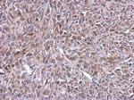 MRPL14 Antibody in Immunohistochemistry (Paraffin) (IHC (P))