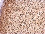 RED Antibody in Immunohistochemistry (Paraffin) (IHC (P))
