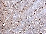 RED Antibody in Immunohistochemistry (Paraffin) (IHC (P))