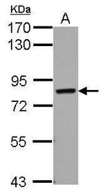 RED Antibody in Western Blot (WB)