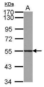 ATL3 Antibody in Western Blot (WB)