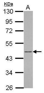 Arfaptin 1 Antibody in Western Blot (WB)