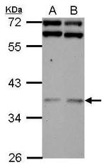 DNAJB7 Antibody in Western Blot (WB)