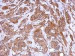 MRVI1 Polyclonal Antibody