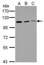 Coronin 7 Polyclonal Antibody