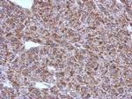 ACSM1 Polyclonal Antibody