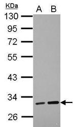 LRRC19 Polyclonal Antibody