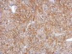 FLRT2 Polyclonal Antibody