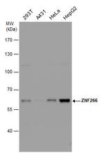 ZNF266 Antibody in Western Blot (WB)