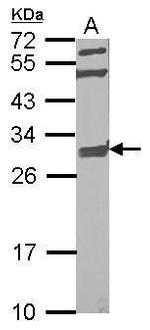 GBAS Antibody in Western Blot (WB)