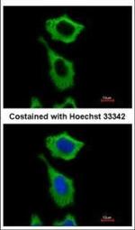 ALDH1A1 Antibody in Immunocytochemistry (ICC/IF)