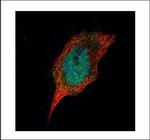 CK1 delta Polyclonal Antibody