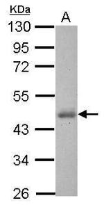 CK1 delta Antibody in Western Blot (WB)