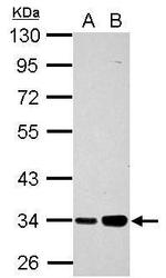 PARP16 Polyclonal Antibody