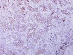 OXSM Polyclonal Antibody