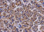 SPATA4 Polyclonal Antibody