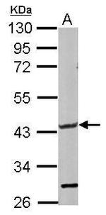 GLT8D1 Antibody in Western Blot (WB)