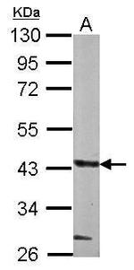 GLT8D1 Polyclonal Antibody