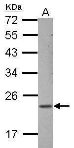 ZNF22 Polyclonal Antibody