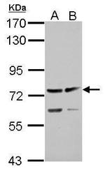 ADAMTS5 Antibody in Western Blot (WB)