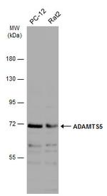 ADAMTS5 Antibody in Western Blot (WB)