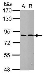 ESRP2 Antibody in Western Blot (WB)