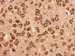 EXOC3 Antibody in Immunohistochemistry (Paraffin) (IHC (P))