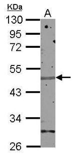 Znf672 Polyclonal Antibody