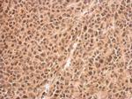 RED Antibody in Immunohistochemistry (Paraffin) (IHC (P))