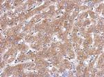 ACOT12 Polyclonal Antibody