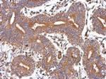 GBAS Polyclonal Antibody