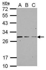 GBAS Antibody in Western Blot (WB)